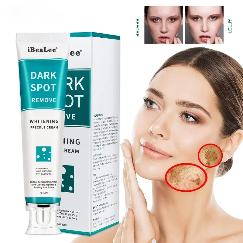 Charcoal Whitening Paste - Crema sbiancante per lentiggini Rimuovi macchie