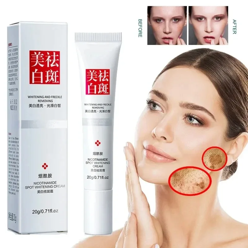 Charcoal Whitening Paste - Sbiadisce le lentiggini Macchie scure Crema