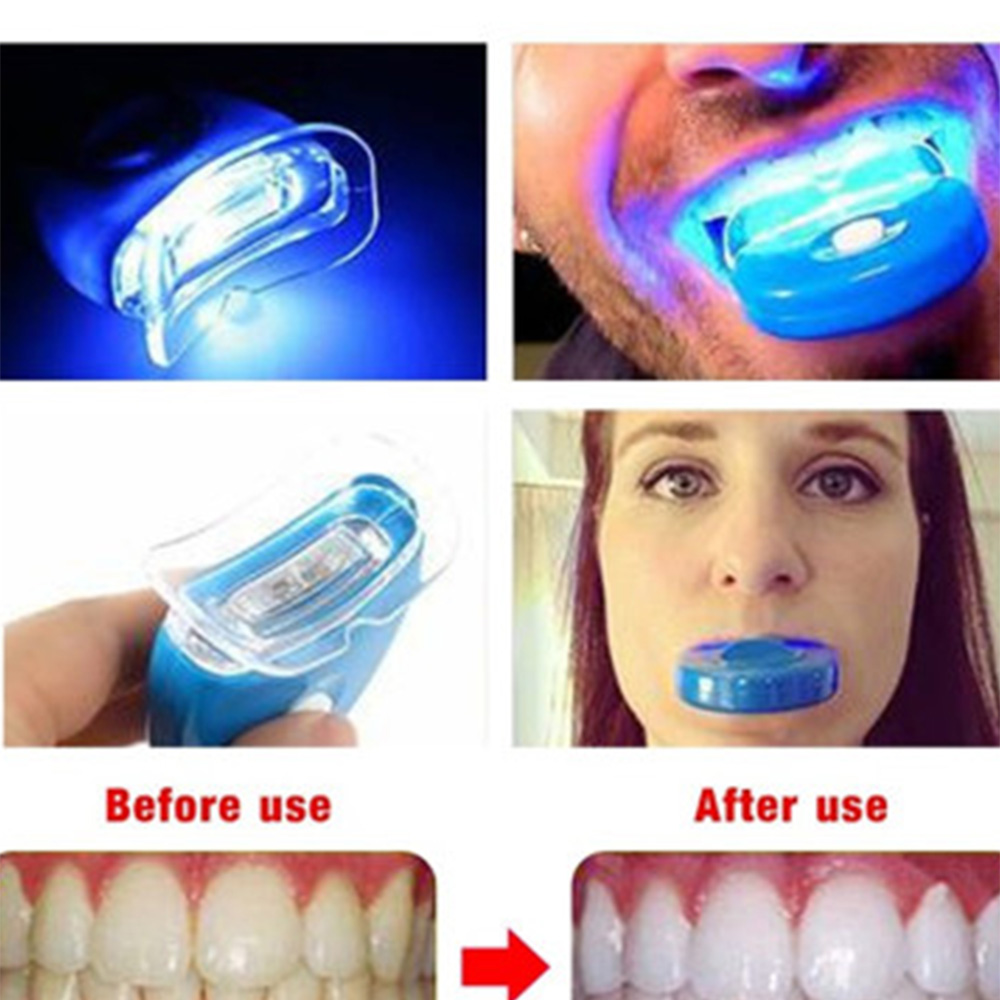 LED Sbiancamento dei denti Luc - Teeth Whitening Laser Treatment recensione e prezzo