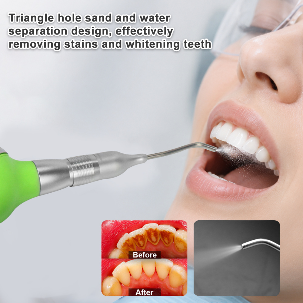Sabbiatrice Dentale con Dispos - Teeth Whitening Options recensione e prezzo