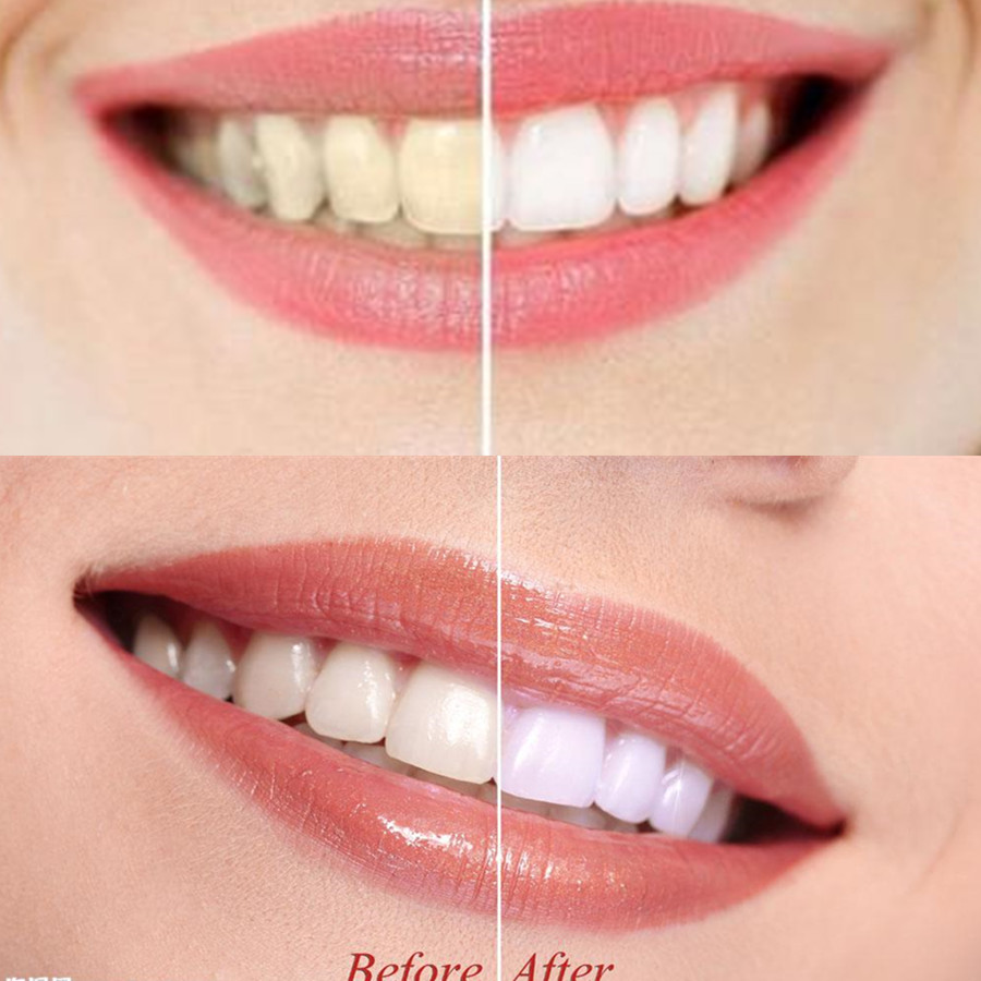 Denti di carbone di bambù dent - Teeth Whitening Zimba recensione e prezzo