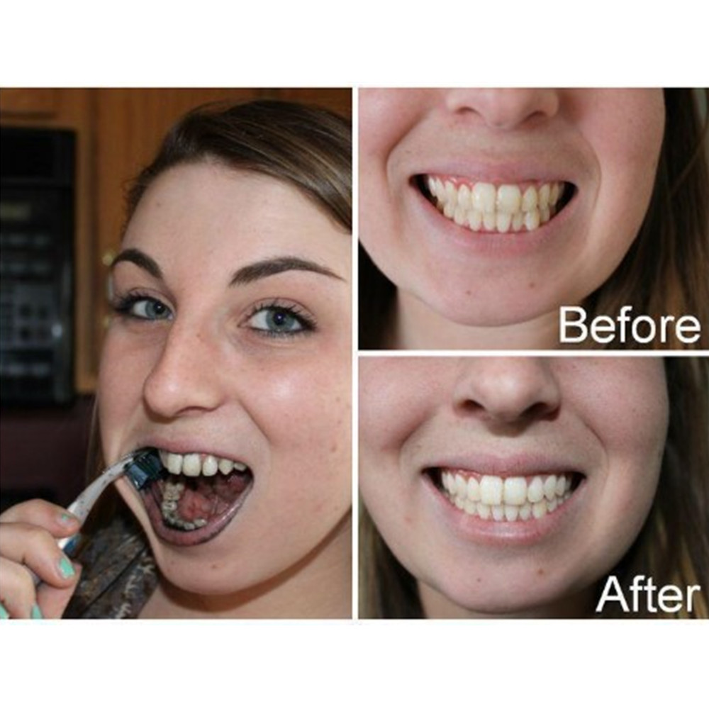 Denti di carbone di bambù dent - Teeth Whitening Zimba recensione e prezzo