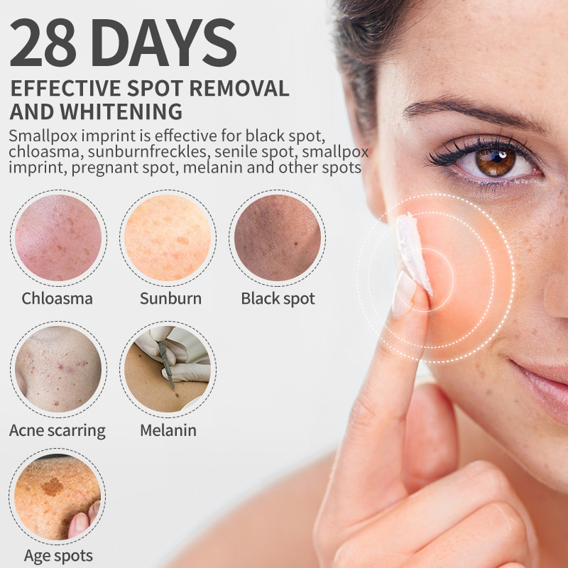 Dimollaure crema sbiancante le - Charcoal Whitening Paste recensione e prezzo