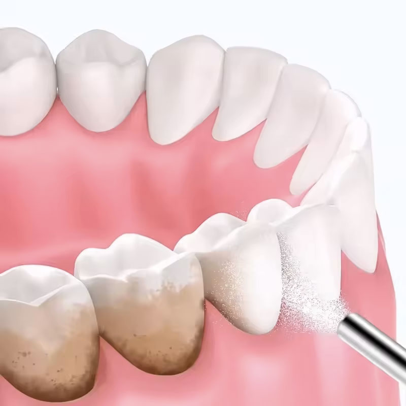 Polvere per Sabbiatura Dentale - Teeth Whitening Zimba recensione e prezzo