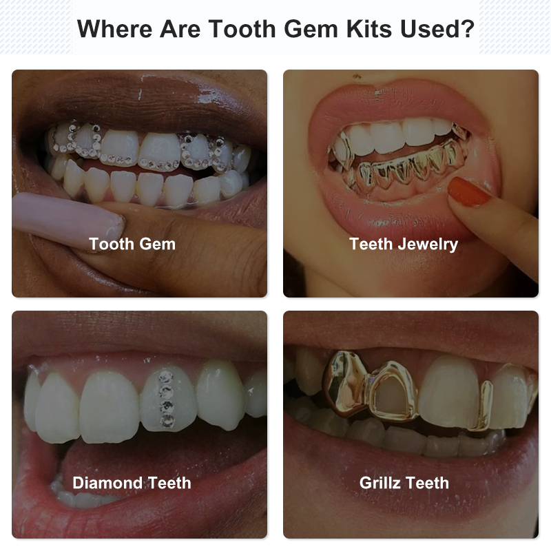 Set di gemme per denti Kit di  - Uv Whitening Kit recensione e prezzo